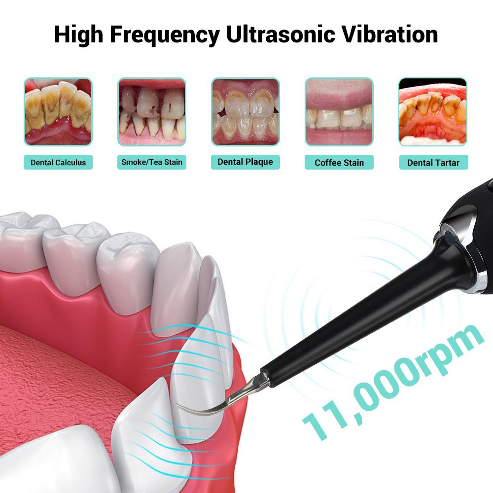 High Frequency Electric Ultrasonic Dental Tartar Plaque Calculus Tooth Remover Set Kits Cleaner with LED Screen White